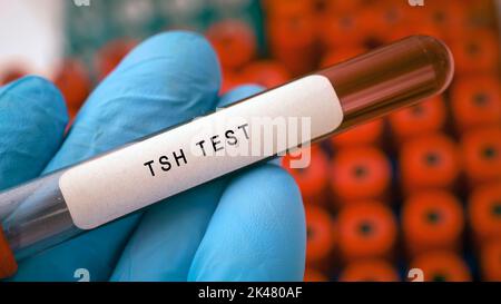 Thyroid stimulating hormone (TSH) test, conceptual image Stock Photo