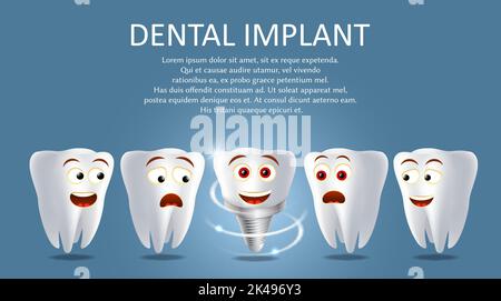 Dental implant poster banner template. Vector realistic illustration. Healthy human teeth and tooth prosthesis. Tooth restoration replacement concept. Stock Vector