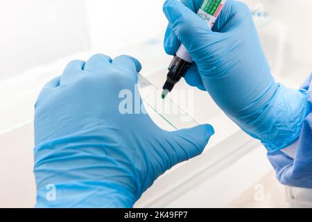 Scientist preparing slides with paraffin embedded tissue samples for immunohistochemistry assay in the laboratory. Stock Photo