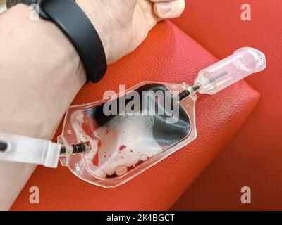 Blood donation, blood transfusion, check specified, fasting, health care. Left arm of caucasian young man with equipment for blood or plasma donations Stock Photo