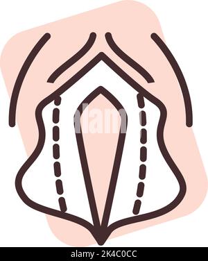 Ginecological surgery, illustration, vector on white background. Stock Vector