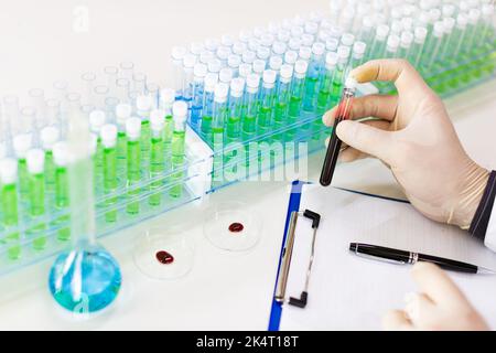 Laboratory. Blood sample in researcher's hands. Close-up. View from the eyes. Stock Photo