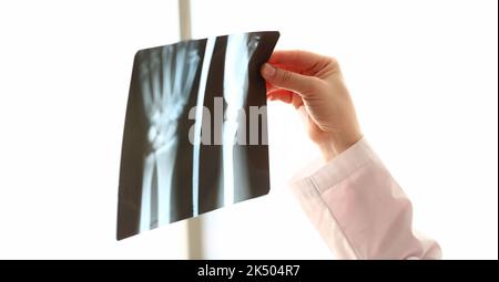 Orthopedic doctor examines image of hands on x-ray Stock Photo