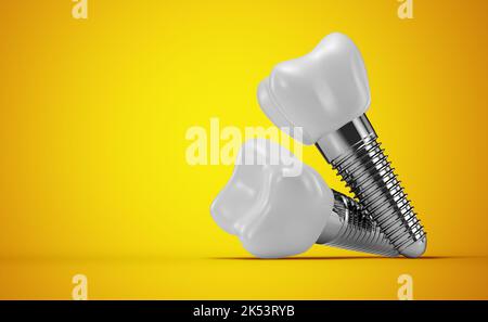dental implants on a yellow background. 3d rendering. Stock Photo