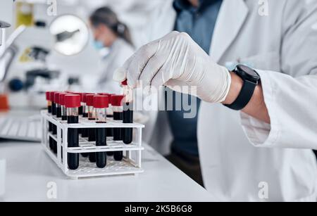 Scientist, science and dna blood sample test tube in pathology lab with gloves doing research and working on vaccine or medical investigation Stock Photo