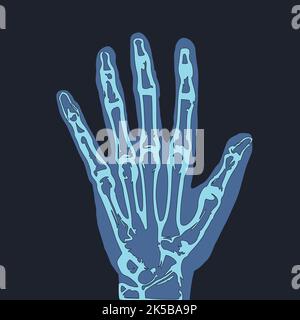 X-ray hand clipart, medical illustration vector. Stock Vector