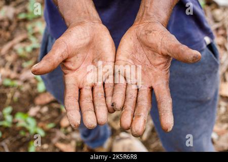 The overworked hands of a peasant. The hands of an elderly farmer disfigured by hard physical labor. Stock Photo