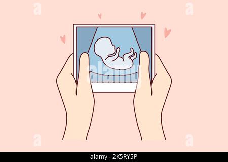 Hands of person holding scan of embryo waiting for baby birth. Future mother with ultrasound picture of baby. Motherhood concept. Vector illustration.  Stock Vector