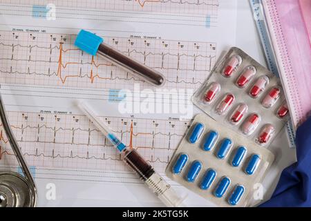As result of examining patients cardiogram, doctor will advise them on how to treat their heart condition Stock Photo