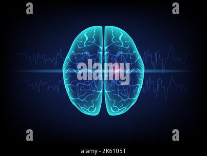 Illustration of human brain and brain wave on technology background. Concept of focal seizure. Stock Vector