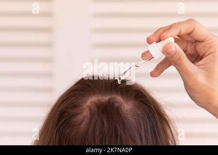Close up view of unrecognizable young man with long hair putting hair growth product with a pippet in the back of the head Stock Photo