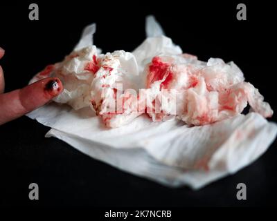 Close up female Left ring finger was cut by knife, injured, bloody finger, The wound was coated with liquid gel plaster. With used crumpled tissue pap Stock Photo