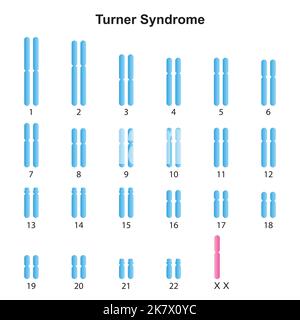 xo karyotype