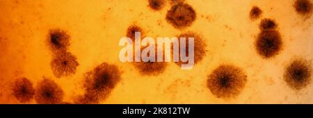 Blood analysis with microbes under microscope, material professional laboratory equipment Stock Photo