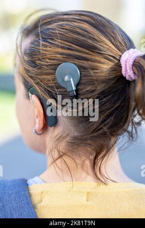 Woman head with cochleral implant hearing aid Stock Photo