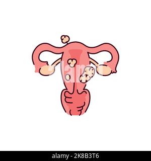 Uterine myoma color line icon. Gynecology problem. Pictogram for web ...
