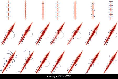 Suture icons set cartoon vector. Wound surgical Stock Vector