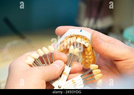 A palette for determining the color of teeth in the hands of a dental orthopedist. Stock Photo