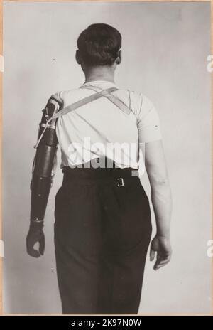 Photography from 'An account of manufacturing at the State Railway's prosthetic workshop in Nässjö', 1932. Visa production of arm prosthesis. Stock Photo