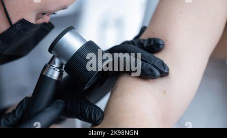 A dermatologist examines a patient's mole through a dermatoscope.  Stock Photo