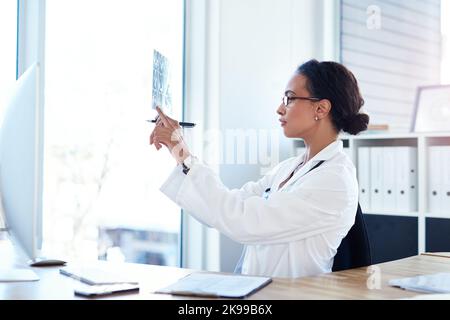 Looks like this bone is knitting together rather slowly. a young doctor reading the results of an x ray in her consulting room. Stock Photo