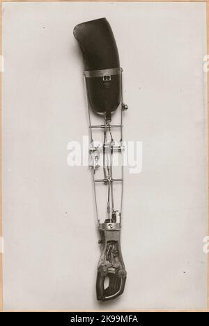 Photography from 'An account of manufacturing at the State Railway's prosthetic workshop in Nässjö', 1932. Visa production of arm prosthesis. Stock Photo