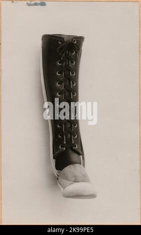 Photography from 'An account of manufacturing at the State Railway's prosthetic workshop in Nässjö', 1932. Visar manufactured foot prosthesis. Stock Photo