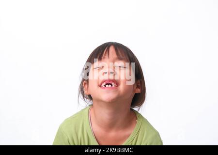 Portrait of an Asian girl with broken upper baby teeth and first permanent teeth. Friendly little girl showing her broken teeth isolated on white back Stock Photo