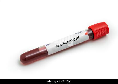 Glucose Tolerance Test GTT Medical check up test tube with biological sample Stock Photo