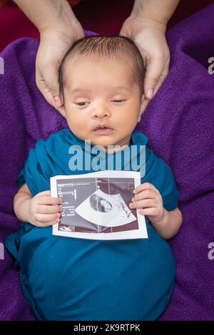 newborn baby holding ultrasound copy in hand and sleeping at mother palm in baby wrap Stock Photo