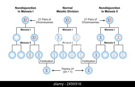 Scientific Designing of Nondisjunction in Trisomy 21. Colorful Symbols. Vector Illustration. Stock Vector