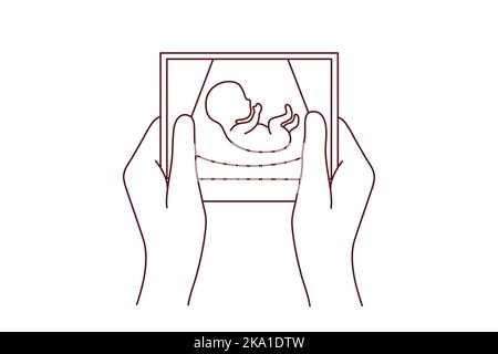 Hands of person holding scan of embryo waiting for baby birth. Future mother with ultrasound picture of baby. Motherhood concept. Vector illustration. Stock Vector