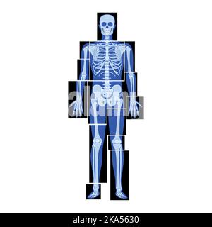 Set of X-Ray Skeleton Human body parts - hands, legs, chest, head, vertebrae pelvis, Bones adult people roentgen front view. 3D realistic flat blue color concept Vector illustration of medical anatomy Stock Vector