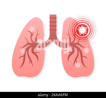 Lungs pain. Vector illustration icon. Isolated vector illustration.Medical icon. Stock Vector