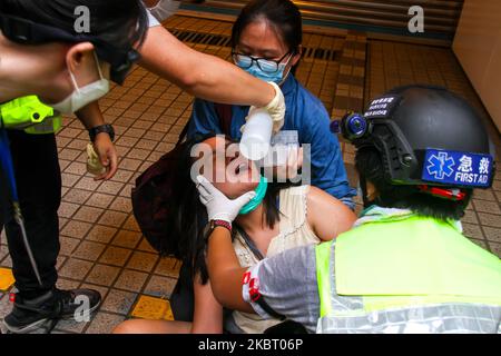A woman is treated after a pepper-spray attack injuries her eye during street protests in Causeway Bay, Hong Kong, China on July 1, 2020. (Photo by Tommy Walker/NurPhoto) Stock Photo
