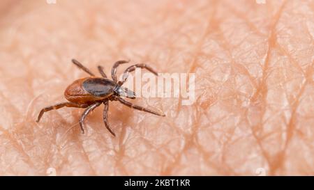 Closeup of female deer tick parasite on human skin background. Ixodes ricinus. Dangerous parasitic insect mite on pink epidermis texture. Lyme disease. Stock Photo