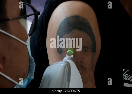 Tattoo removal  Dr Sajjas Clinic in Tirupati