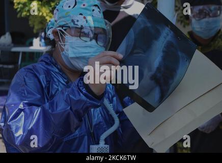 dr. Yosephine Pratiwi (blue fashion) examines the results of an X-ray of the lungs of a positive patient for Covid-19, before the treatment process using the steam method at a health clinic in Malang, East Java, Indonesia. August 25, 2021. Doctor Yosephine Pratiwi uses the steam method to treat Covid-19 positive patients. Because it accelerates the discharge of phlegm in the lungs, thereby increasing the patient's oxygen saturation by 5 percent with a treatment time of 3 minutes. Patients are charged Rp 150,000 to Rp 250,000 per person, for the purchase of medicines, nebulizer masks and free f Stock Photo