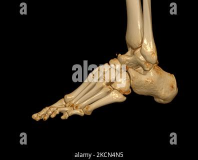 3D rendering  of the foot bones for diagnosis bone fracture and rheumatoid arthritis from CT scannner. Stock Photo