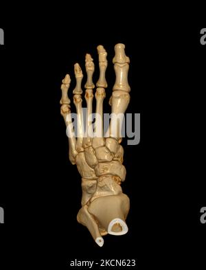3D rendering  of the foot bones for diagnosis bone fracture and rheumatoid arthritis from CT scannner. Stock Photo