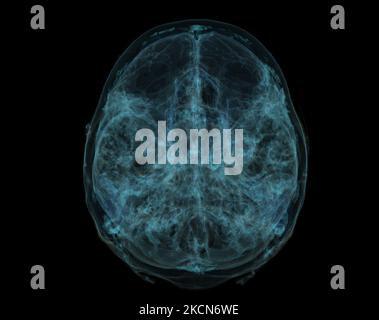 Human Skull, Brain by CT Scan. X-ray Visualization Inside Of Skull. 3D Illustration Render. Stock Photo