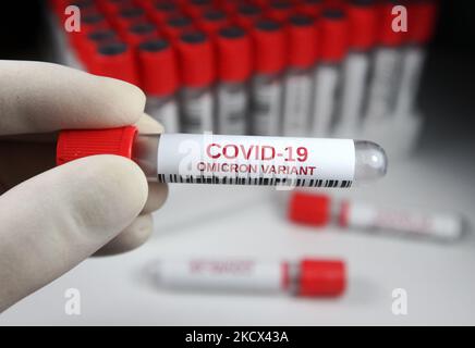 A test sample tube labeled 'COVID-19 Omicron variant' is pictured in this illustration photo of a new coronavirus SARS-CoV-2 variant B.1.1.529, taken in Kyiv on 02 December, 2021. (Photo by STR/NurPhoto) Stock Photo