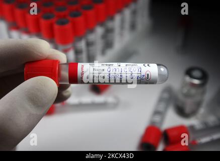 A test sample tube labeled 'Omicron SARS-CoV-2' is pictured in this illustration photo of a new coronavirus SARS-CoV-2 variant B.1.1.529, taken in Kyiv on 02 December, 2021. (Photo by STR/NurPhoto) Stock Photo