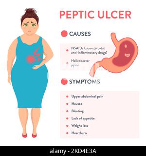 Peptic ulcer symptoms, illustration Stock Photo