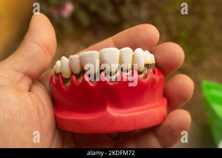 A hand holding the medical dentures made of acrylic Stock Photo