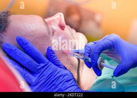 Close-up of young man having hyaluronic acid, botox or other facial rejuvenation treatment at medical beauty clinic Stock Photo