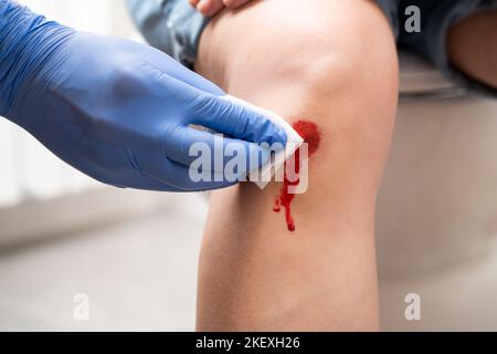 Nurse helping her patient perform first aid knee injury after she has been an accident Stock Photo