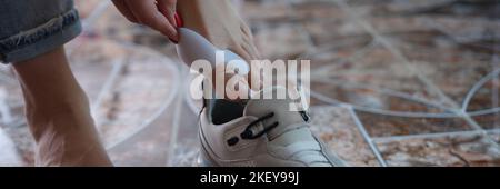 Hallux valgus on women legs with lock puts on sneaker closeup Stock Photo