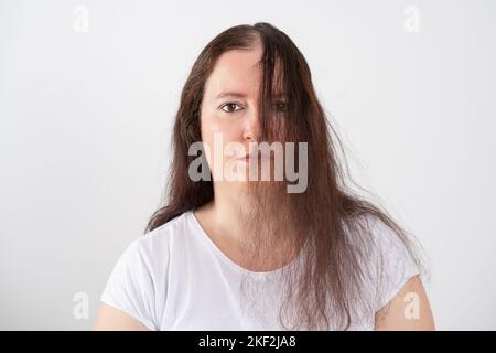 Upset middle aged woman with alopecia looking at camera, hair loss concept Stock Photo