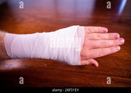 bandaging an arm from a snake bite in australia Stock Photo